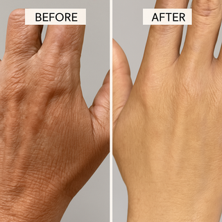 Numiere Hand Glow – LED Light Therapy for Hand & Wrist Rejuvenation - luminanrg