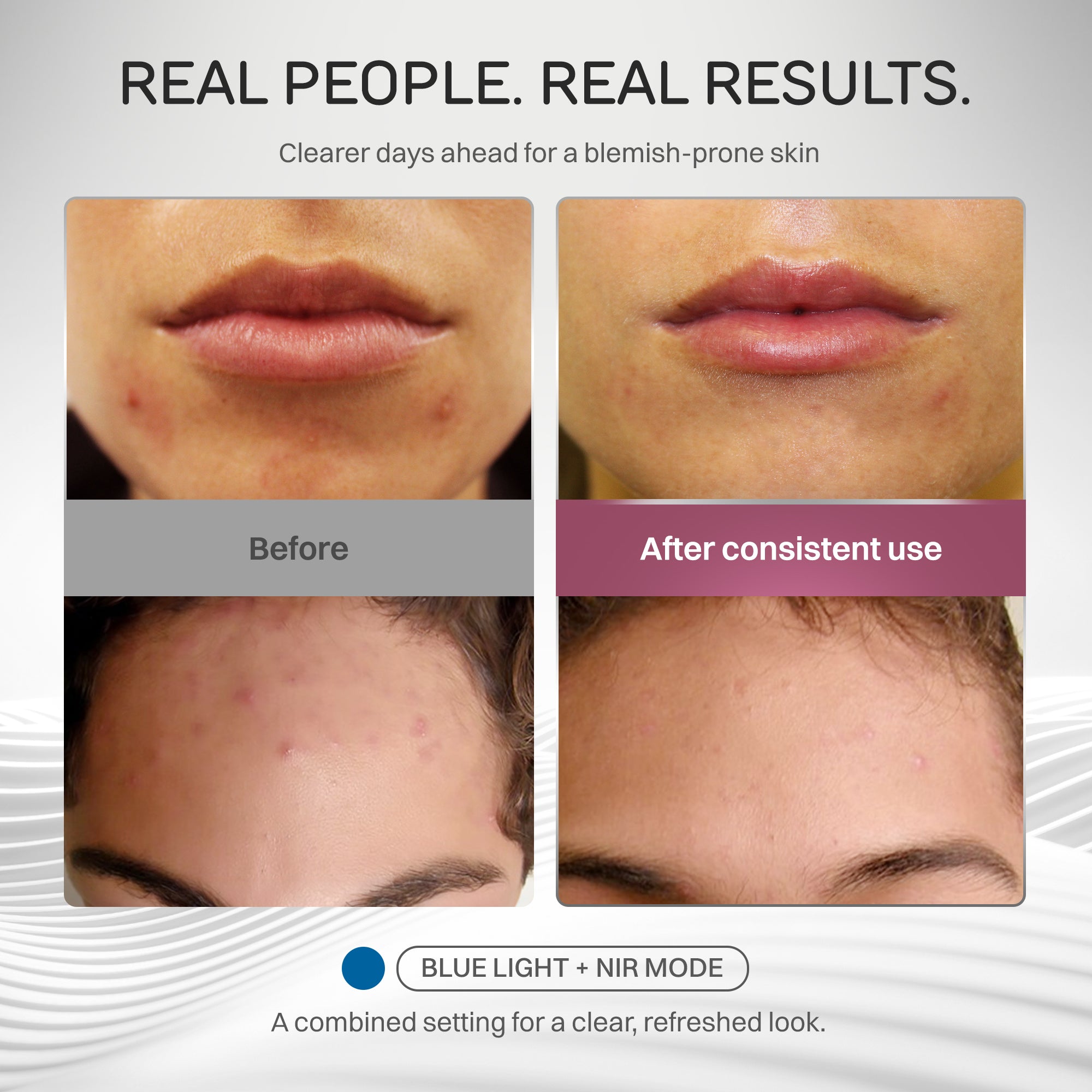Time Keeper Wrinkle Reducing LED Face Mask – Numiere - Lumina NRG