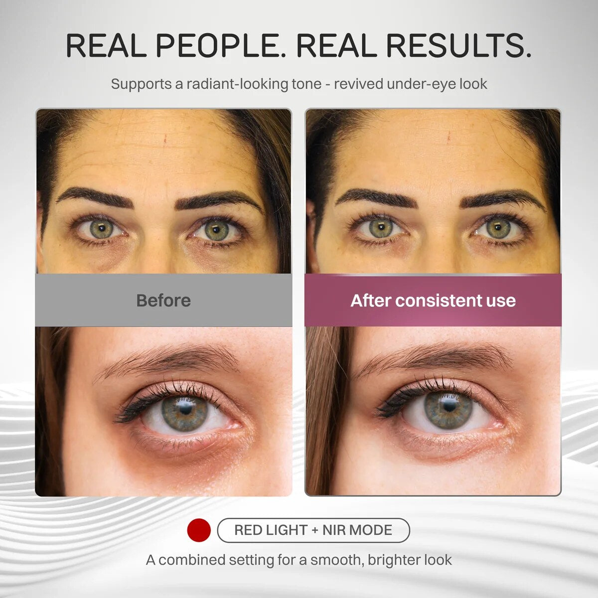 Real People. Real Results. Brand-provided forehead and under-eye comparisons, labeled Before and After consistent use, Red Light plus NIR mode.